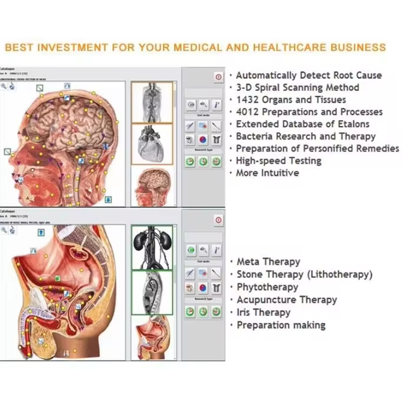 Metatron Hunter 4025 NLS Biore - đánh giá và giá Holistic Health & Wellness